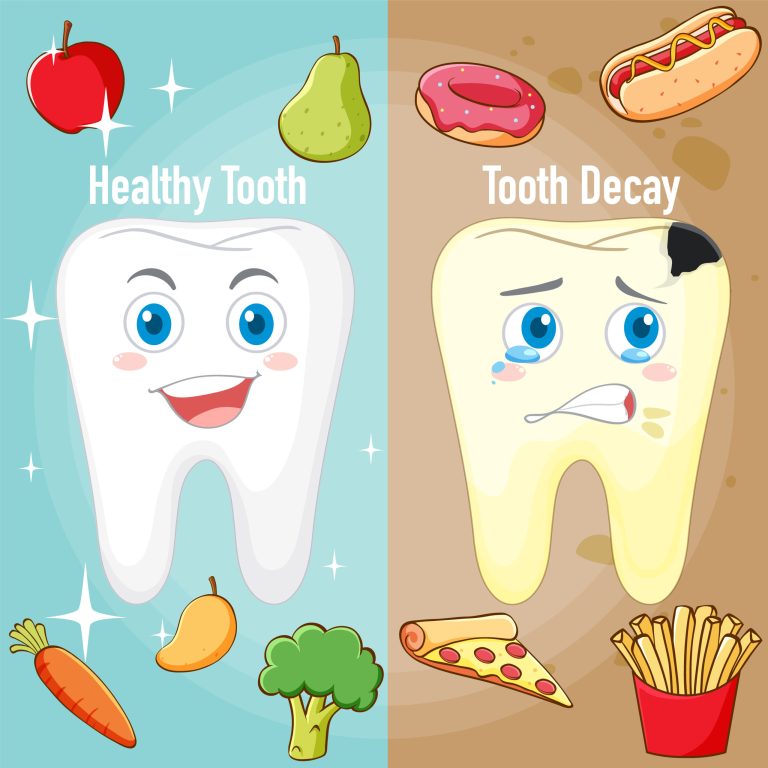 Infographic of healthy tooth and tooth decay illustration